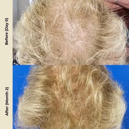 Hair2
